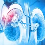 Kidney Cancer: కిడ్నీ కాన్సర్ బారిన పడకుండ ఉండాలంటే.. ఈ జాగ్రత్తలు పాటించాల్సిందే!