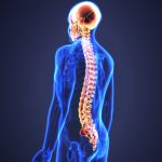 Spinal Stroke: ‘స్పైనల్ స్ట్రోక్’ ఎంత ప్రమాదకరమో తెలుసా.. వాటి లక్షణాలు ఎలా ఉంటాయంటే..