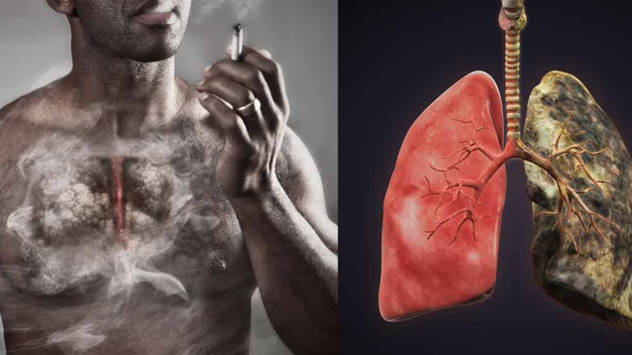 Cigarette Effect on Body: రోజుకో సిగరెట్.. మీ ప్రాణానికి ముప్పు అని తెలుసా..?