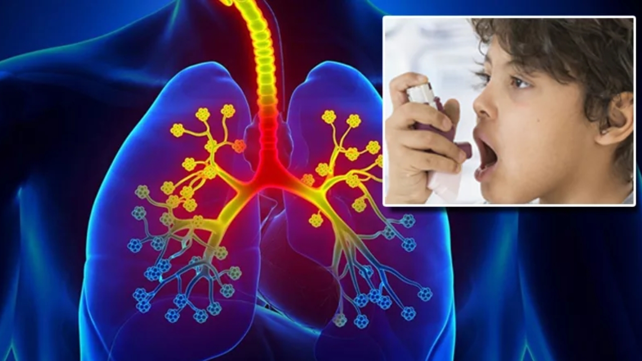 Stages of Asthma ఆస్తమాలో 4 దశలు.. ఇందులో ఏది అత్యంత ప్రాణాంతకమో తెలుసా?