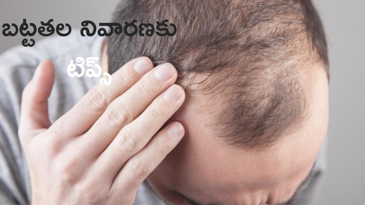 Hair Loss Prevention: బట్టతల రాకుండా ఉండాలంటే.. ఈ టిప్స్ ట్రై చేయండి