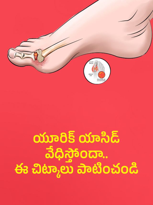Tips to reduce Uric Acid
