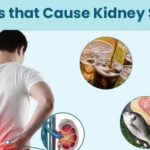 Kidney Stones Causes Food: ఈ ఆహారాలు తింటున్నారా..? అయితే కిడ్నీ స్టోన్స్ గ్యారంటీ..!