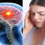 Brain Tumor Diseases: తలనొప్పిని నిర్లక్ష్యం చేస్తున్నారా.. బ్రెయిన్ ట్యూమర్ లక్షణాలు కావొచ్చు..