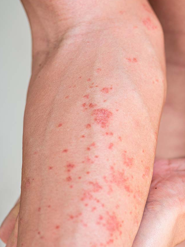Stop Using these Products to Avoid Skin Cancer