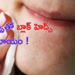 Blackheads Removal Tips: బ్లాక్‌హెడ్స్ తో ఇబ్బంది పడుతున్నారా..? అయితే ఈ టిప్స్ మీ కోసమే