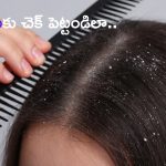 Dandruff Control Tips: చుండ్రు సమస్యతో విసిగిపోయారా ? ఈ టిప్స్‌తో చెక్ పెట్టండి