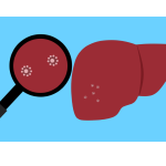 World Hepatitis Day 2024: ప్రమాద ఘంటికలు మోగిస్తున్న హెపటైటిస్ ? హెపటైటిస్ అంటే ఏమిటి  ?