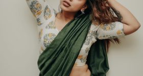 Hair Fall Tips: జుట్టు ఎక్కువగా రాలి బట్టతల వస్తుందా? ఈ జాగ్రత్తలు పాటించండి!