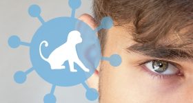 Mpox Symptoms: ఎంపాక్స్ సోకితే నరకమే..బాధితుడు చెప్పిన భయానక లక్షణాలు ఇవే, వణికిపోతారు!