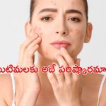 Omega 3 Fatty Acids: ఒమేగా 3 ఫ్యాటీ యాసిడ్స్ తో ముఖంపై మొటిమలు పోతాయా ?