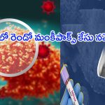 Monkeypox Case in India: భారత్‌ను వణికిస్తున్న మంకీపాక్స్.. రెండో కేసు నమోదు.