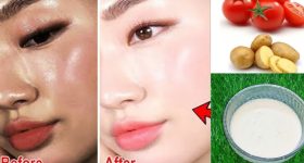Tomato and Potato Face Pack: ఈ ఫేస్ ప్యాక్‌కు ఎవ్వరైనా ఫిదా అవ్వాల్సిందే !