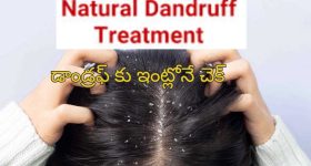 Home Remedies For Dandruff : డాండ్రఫ్ తో బాధపడుతున్నారా?.. ఈ చిట్కాలు మీ కోసమే..