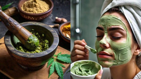 Neem Face Pack: ఈ ఫేస్ ప్యాక్‌తో మొటిమలు మాయం !