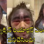 Alexis Lorenze Viral: టెటనస్ వ్యాక్సిన్ తీసుకోగానే సీరియస్ రియాక్షన్.. చావుబతుకుల్లో యువతి