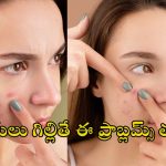 Popping pimples Side Affects: మొటిమలను గిల్లితే ఈ సైడ్ ఎఫెక్ట్స్ తో ప్రమాదం.. మీ అందం కాపాడుకోండిలా..