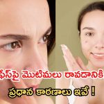 Causes Of Pimples: మొటిమలు రావడానికి కారణాలు ఇవే !