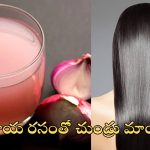 Dandruff Home Remedies: ఇంట్లోనే చుండ్రు తగ్గించుకోండిలా ?