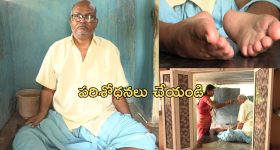 Muscle Atrophy : నలభై ఏళ్లుగా మంచానికే పరిమితం.. ప్రభుత్వానికి శరీరం ఇస్తానంటున్న బాధితుడు