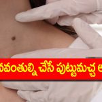 Lucky moles: ధనవంతుల్ని చేసే పుట్టుమచ్చలు ఎక్కడెక్కడ ఉంటాయో తెలుసా? ఇప్పుడే చెక్ చేసుకోండి