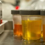 Urine: మూత్రం ఆ రంగులో వస్తుందా? ప్రాణాలు పోతాయ్ జాగ్రత్త!