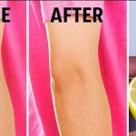 Dark Elbows: మోచేతుల నలుపుదనానికి చెక్ పెట్టండిలా !