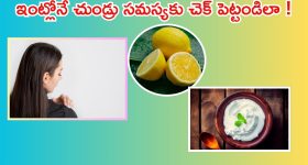 Dandruff: ఇంట్లోనే చుండ్రు తగ్గించుకోండిలా ?