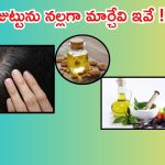 White Hair: హెయిర్ కలర్ అవసరమే లేదు.. ఇలా చేస్తే తెల్లజుట్టు నల్లగా మారిపోవడం పక్కా !