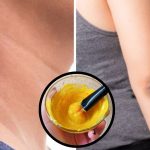 Dark Neck Elbows: వీటితో మెడ, మోచేతులపై ఉన్న నలుపు మాయం