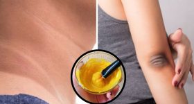 Dark Neck Elbows: వీటితో మెడ, మోచేతులపై ఉన్న నలుపు మాయం