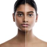 Skin Discoloration: మీ చర్మం క్రమంగా నల్లగా మారుతోందా.. కారణాలివే!