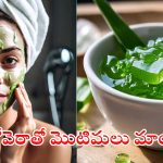 Aloe Vera: కలబందతో ముఖంపై నల్ల మచ్చలు మాయం