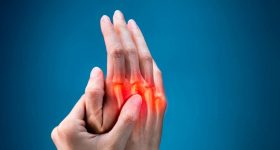 Arthritis: కీళ్ల నొప్పులతో ఇబ్బంది పడుతున్నారా ?