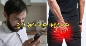 Leave For Piles: 'నీకు పైల్స్ ఉందని ఆధారం చూపించు'.. లీవ్ అడిగినందుకు బాస్ కండీషన్.. ఎంత పని చేశాడంటే?.