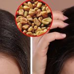 Fenugreek For Dandruff: ఈ గింజలు కొన్ని చాలు.. మీ చుండ్రును పూర్తిగా తగ్గించడానికి !
