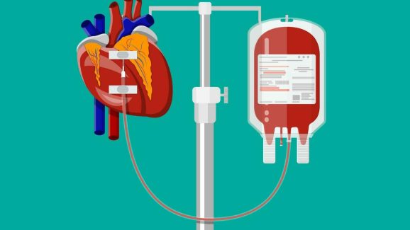 Heart Disease: మహిళలకు గుండె జబ్బులు తక్కువ వస్తాయి ?.. ఎందుకో కారణాలు తెలిస్తే షాక్ అవుతారు