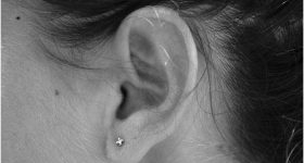 Ear wax problems: చెవిలో గులిమి ఎలా ఏర్పడుతుంది? దాని ఉపయోగం ఏమిటి?