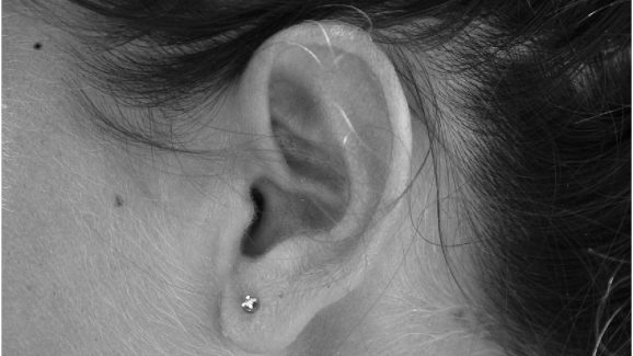 Ear wax problems: చెవిలో గులిమి ఎలా ఏర్పడుతుంది? దాని ఉపయోగం ఏమిటి?