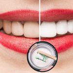 Teeth: మీ పళ్ళు పసుపు రంగులోకి మారాయా ? ఈ చిట్కాలు పాటిస్తే చాలు మిలమిల మెరిపోతాయ్
