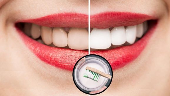 Teeth: మీ పళ్ళు పసుపు రంగులోకి మారాయా ? ఈ చిట్కాలు పాటిస్తే చాలు మిలమిల మెరిపోతాయ్