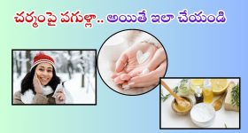 Winter Skin Care: చలికాలంలో చర్మంపై పగుళ్లతో ఇబ్బంది పడుతున్నారా ? అయితే ఇలా చేయండి