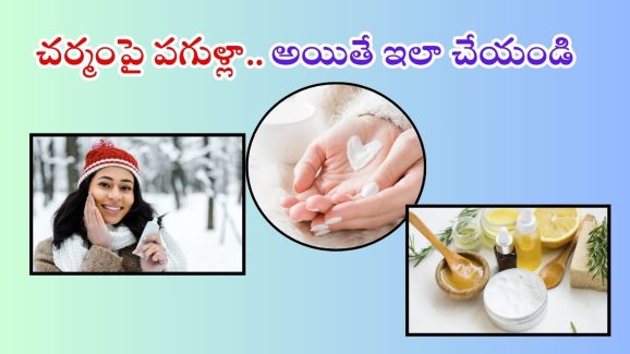 Winter Skin Care: చలికాలంలో చర్మంపై పగుళ్లతో ఇబ్బంది పడుతున్నారా ? అయితే ఇలా చేయండి