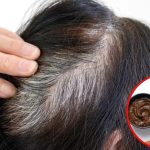 White Hair: మీ తెల్లజుట్టు నల్లగా, అందంగా మారిపోవాలా ? అయితే  ఇది ట్రై చేయండి