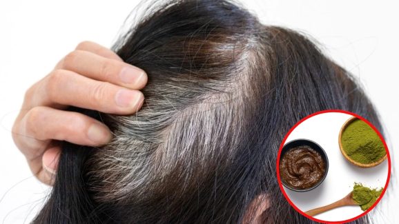White Hair: మీ తెల్లజుట్టు నల్లగా, అందంగా మారిపోవాలా ? అయితే  ఇది ట్రై చేయండి