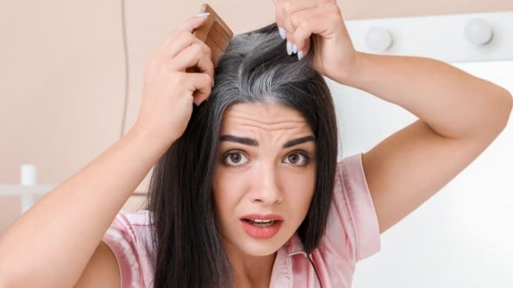 White Hair: చిన్న వయస్సులోనే.. తెల్ల జుట్టు రావడానికి కారణాలేంటో తెలుసా ?