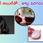 Homemade Onion Oil: ఉల్లిపాయతో ఇలా హెయిర్ ఆయిల్ తయారు చేసుకుని వాడితే.. జుట్టు రాలనే రాలదు