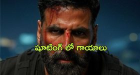 Akshay Kumar : షూటింగ్ స్పాట్ లో ప్రమాదం... అక్షయ్ కుమార్ కు గాయాలు