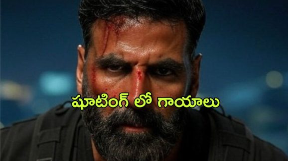 Akshay Kumar : షూటింగ్ స్పాట్ లో ప్రమాదం… అక్షయ్ కుమార్ కు గాయాలు