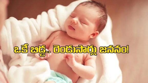 Baby Born Twice: రెండుసార్లు పుట్టిన ఒకే బిడ్డ.. ఆధునిక వైద్యశాస్త్రంలో అద్భుతం!
